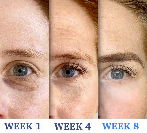 Anti ageing and Dark circle serum