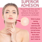 Exopatch™️ - Pack Of 72 Patches